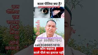 काला पीलिया किया है । Black jaundiceliverhepatitis cliver virus attack [upl. by Strepphon24]