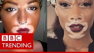 Winnie Harlow  The model whos bringing vitiligo into the open  BBC Trending [upl. by Cioffred]