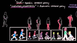 Khan Academy  Types of Cerebral Palsy Part 2 Dyskinetic amp Ataxic [upl. by Spancake988]