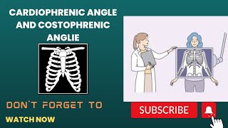 costophrenic and cardiophrenic angle and lungs zone [upl. by Arais]