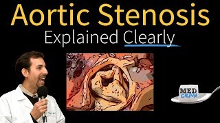 Aortic Stenosis Explained Clearly  Diagnosis and Treatment [upl. by Aynnek]