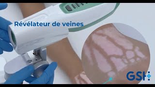 Révélateur de veines  Veincas  V800F [upl. by Noremmac]