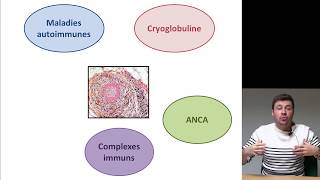 Vascularites des maladies autoimmunes [upl. by Atekihs]