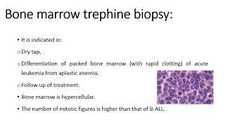 T Lymphoblastic Leukemia Lymphoma [upl. by Boothman]