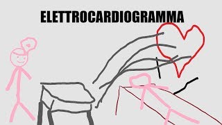 I segreti più o meno dellELETTROCARDIOGRAMMA  Spiegazione [upl. by Alveta]