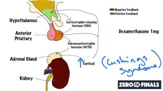 Understanding The Dexamethasone Suppression Test [upl. by Glynn]