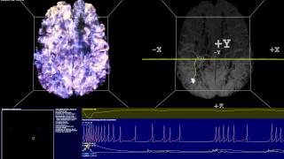 Simulation of Thalamocortical Brain Network  Spiking Neural Network 14M Neurons 140M Synapses [upl. by Launam48]