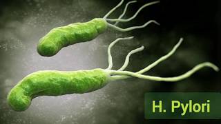 Helicobacter pylori identification diagnosis and treatment [upl. by Anekam]