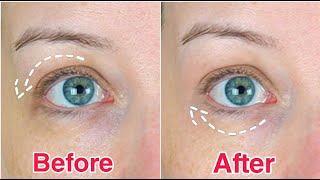 10 SECOND FIX FOR DOWNTURNED EYES with 1 Product [upl. by Asteria494]