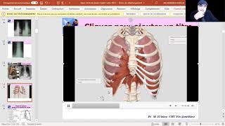 8 Etapes danalyse de la qualité de la radiographie thoracique cul de sac et explication en 3D [upl. by Alejna93]