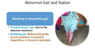 Motor System Examination Part12  Gait amp Station  CNS Examination  Pediatrics [upl. by Anawahs]