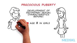 Pediatrics – Abnormal Pubertal Development By Paola Luca MD [upl. by Lemrahc810]