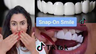 Orthodontist Reacts To SnapOn Veneer TikToks [upl. by Muhcon]