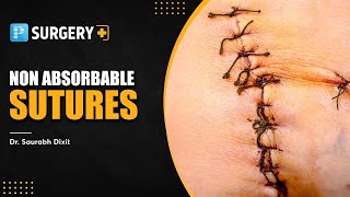 Non Absorbable Sutures General Surgery [upl. by Emerej]