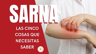 SARNA  Las 5 cosas que necesitas saber [upl. by Thane562]