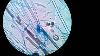 Aspergillus [upl. by Reggie379]