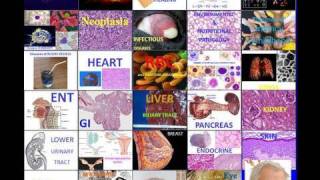 Online Pathology Courseavi [upl. by Lacsap]