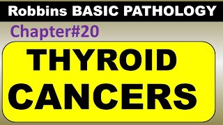 Ch20  Thyroid Cancers  Endocrine Pathology Robbins Pathology  Dr Asif Lectures [upl. by Yerroc]