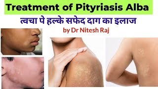 सफेद दाग का इलाजPityriasis Alba treatment in hindi drniteshraj [upl. by Nilde941]