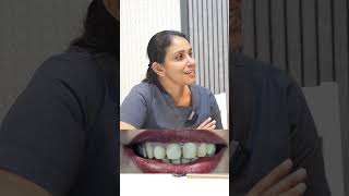 Dental veneers procedure for smile correction dentalexperience [upl. by Guthry]