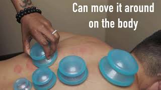 EDGE Cupping Therapy Set by Lure Essentials  Benefits of Cupping and How to DIY Cupping at Home [upl. by Polk522]