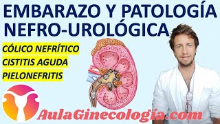 EMBARAZO Y PATOLOGÍA UROLÓGICA CÓLICO CISTITIS PIELONEFRITIS  Ginecología y Obstetricia [upl. by Aliuqehs]