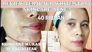 WHITE STORY ACNE SKINCARE  REVIEW WHITE STORY SKINCARE WHITE STORY ACNE CREAMACNE SOOTHING SERUM [upl. by Carberry152]