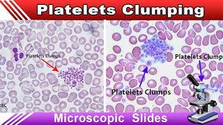 Platelets Clumping  Increase Your Identification Skills [upl. by Hsital726]