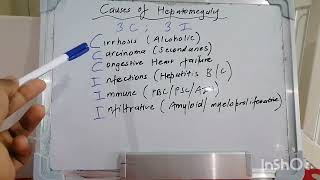 Mnemonic 57  Causes of Hepatomegaly [upl. by Adorne567]