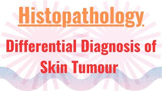 Differential Diagnosis of Skin Tumour [upl. by Leahcimnhoj]