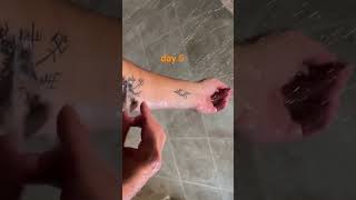 Tattoo healing day 5 saniderm removal [upl. by Drolyag743]