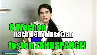 8 Wochen nach dem einsetzen der festen ZAHNSPANGE  Orthodentix [upl. by Beshore]