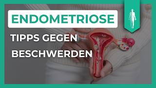 Pille Schmerzmittel amp Alternativen Die besten Tipps für Endometriose und Adenomyose [upl. by Tebazile]