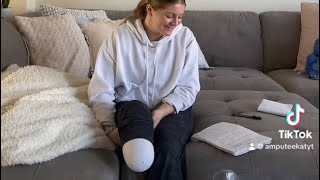 6 months post amputation  balance pain and what a prosthetic leg feels like as an amputee [upl. by Perrins928]