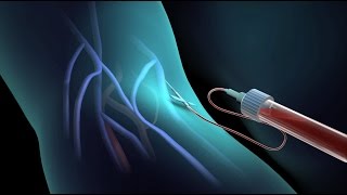 Blood Test for Cholesterol  Nucleus Health [upl. by Llerdnam217]