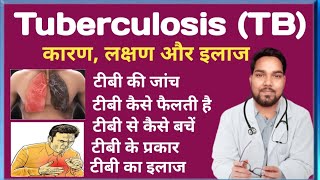 Tuberculosis TB के लक्षण कारण और इलाज तथा जांचे  Tuberculosis Symptoms in Hindi [upl. by Enitsenrae]