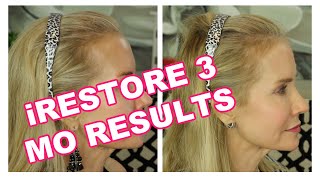 3 MONTHS IRESTORE RESULTS  BEFORE AND AFTER PICS  LASER LIGHT THERAPY FOR HAIR LOSS IN WOMEN [upl. by Rodrich]