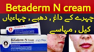 betaderm cream  betaderm n cream  betaderm n cream uses in urdu  betaderm n cream betaderm cream [upl. by Antonino]