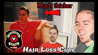 The 4 Keys to Overcoming Hair Loss Forever Male Pattern Baldness Reversal [upl. by Lansing752]