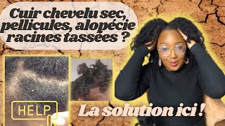 Pourquoi prendre soin de ton cuir chevelu pour des cheveux crépus sains et longs [upl. by Dustie]