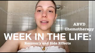 ABVD Side Effects and Recovery  Week In My Life Chemotherapy [upl. by Notgnirrac658]