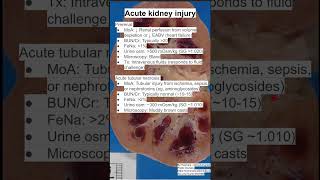 Acute kidney injury [upl. by Ocicnarf]