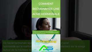 comment reconnaitre une acne hormonale [upl. by Maitilde]