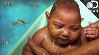 The Devastating Zika Virus Explained [upl. by Notyard]