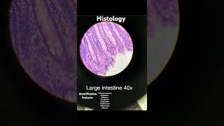 ANATOMY  HISTOLOGY  LARGE INTESTINES  IDENTIFICATION FEATURES mbbs anatomy life histology [upl. by Wilder]