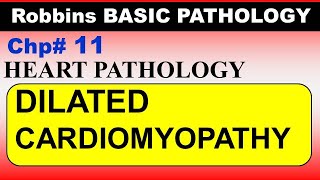 Chp11 Robbins Patho  Heart Pathology  DILATED Cardiomyopathy  Dr Asif Lectures [upl. by Idnyc746]