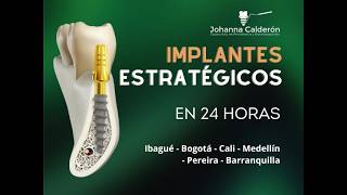 IMPLANTOLOGÍA ESTRATÉGICA  IMPLANTES DENTALES EN 24 HORAS COLOMBIA BOGOTÁIBAGUÉ CALI MEDELLÍN [upl. by Alit]