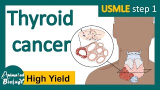 Thyroid cancer  Papillary Follicular Medullary amp Anaplastic  Symptoms Diagnosis Treatment [upl. by Alexia]