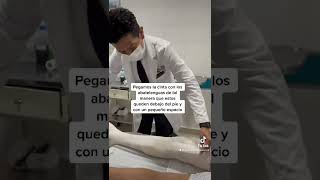 Asi se hace una traccioncutanea para fractura de femur improvisada 🦴👨‍⚕️ [upl. by Eilime]