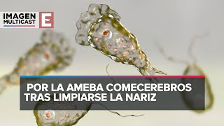 Ameba come cerebros Joven murió tras lavarse la nariz con agua del grifo [upl. by Nilorac]